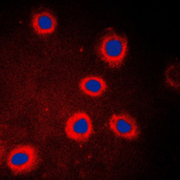 ADCY9/Adenylate Cyclase 9 Antibody