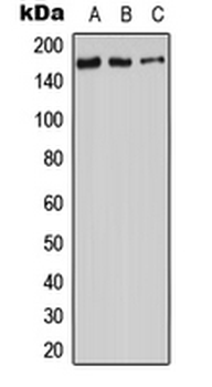 ADCY9/Adenylate Cyclase 9 Antibody