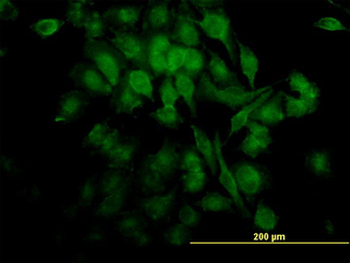 RELA/NFKB p65 Antibody