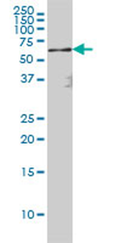 RELA/NFKB p65 Antibody