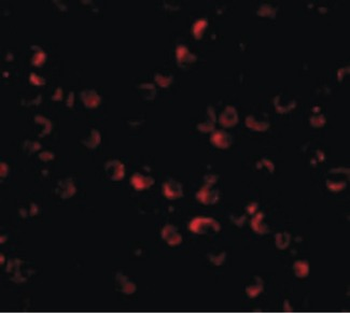 HUWE1/ARFBP1 Antibody