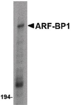 HUWE1/ARFBP1 Antibody