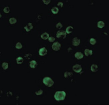 TNFRSF10B/Killer/DR5 Antibody