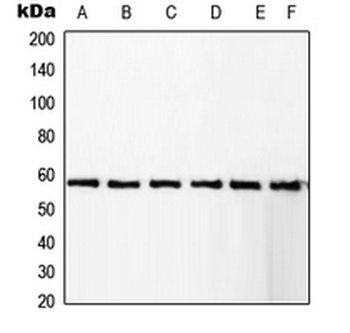 RCBTB1 Antibody