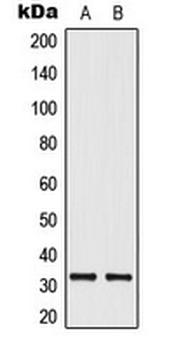 ELOVL1 Antibody