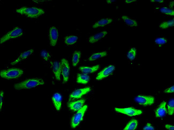 LYPLA2 Antibody