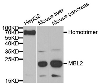 MBL2/Mannose Binding Protein Antibody