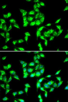 ANTXR1/TEM8 Antibody