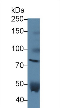 VCAN/Versican Antibody