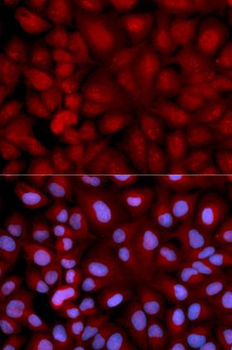 SNCG/Gamma-Synuclein Antibody