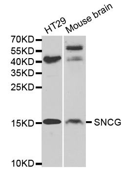 SNCG/Gamma-Synuclein Antibody