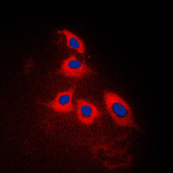 ARRDC3 Antibody