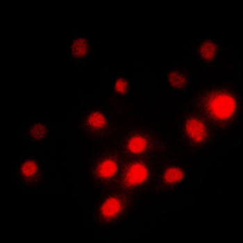 TFE3 Antibody
