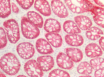 CLDN4/Claudin 4 Antibody