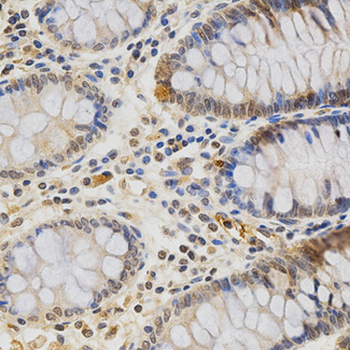 MDK/Midkine Antibody