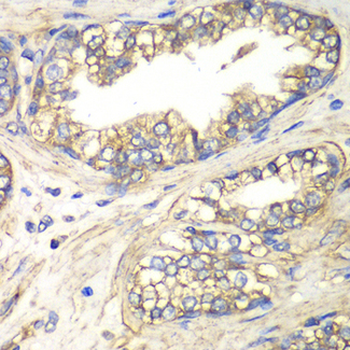 SLC4A4/NBC1 Antibody
