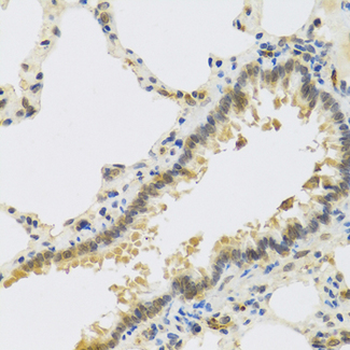 RSPO1/RSPO Antibody