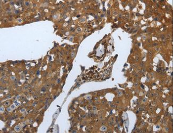 SLC34A2/NaPi-2b Antibody