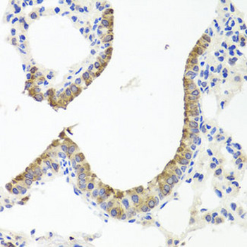 TTR/Transthyretin Antibody