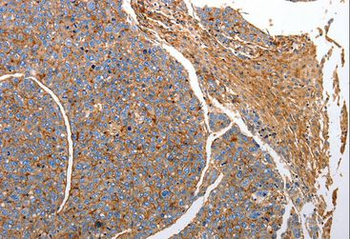CD151 Antibody
