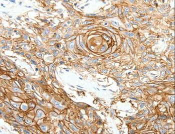 SCN10A/Nav1.8 Antibody