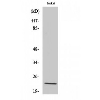 VEGFB Antibody