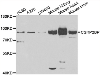 CSRP2BP Antibody