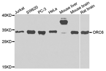 ORC6/ORC6L Antibody