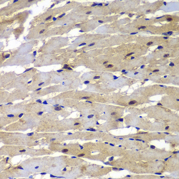 PSMB8/LMP7 Antibody