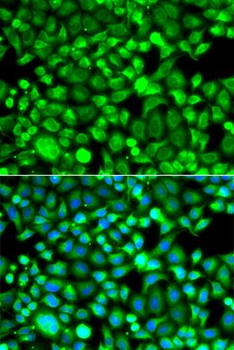 PSMB8/LMP7 Antibody