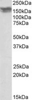 NCAM/CD56 Antibody