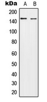 NEDL2/HECW2 Antibody