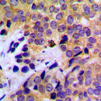 KRT8/CK8/Cytokeratin 8 Antibody