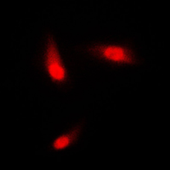 KRT8/CK8/Cytokeratin 8 Antibody