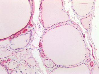 OCLN/Occludin Antibody