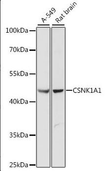 CSNK1A1/CK1 Alpha Antibody