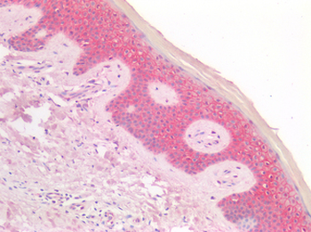 CTNNB1/Beta Catenin Antibody