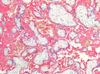 GH/Growth Hormone Antibody