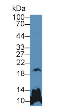 GH/Growth Hormone Antibody