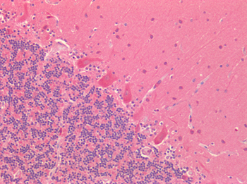 NPRB/NPR2 Antibody