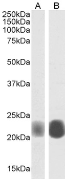 CAV1/Caveolin 1 Antibody
