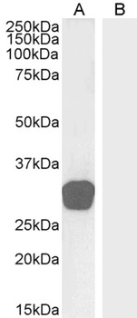 GDF15 Antibody