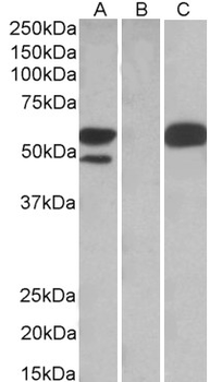 TRIM21/RO52 Antibody