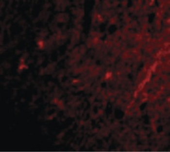 GRIK1/GLUR5 Antibody