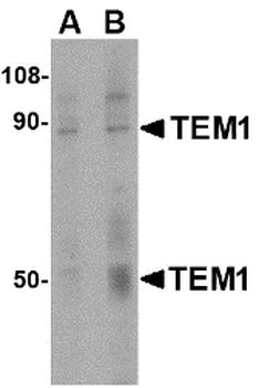 TEM1/CD248 Antibody