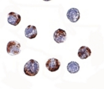 ATG16L1/ATG16L Antibody