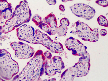 ADAM12 Antibody