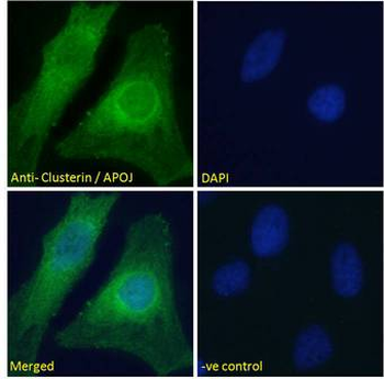 CLU/Clusterin Antibody