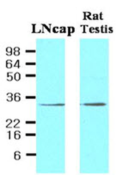 STEAP1/STEAP Antibody