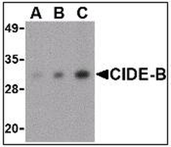 CIDEB Antibody